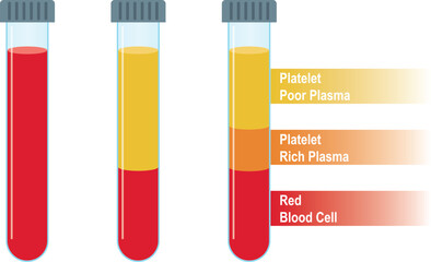 The structure of blood in test tubes. Platelet rich plasma Platelet poor plasma and Red blood cells. Preperation for Platelet-Rich Plasma (PRP) Injection. Centrifuge vector on white
