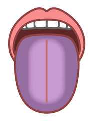 Obraz premium 紫の舌、舌診、病的な舌のイラスト