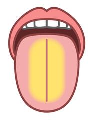 黄色の舌、舌診、病的な舌のイラスト