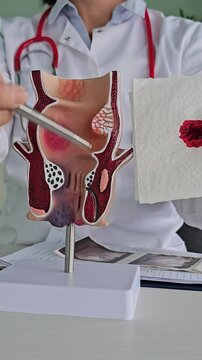 Proctologist, rectum and napkin with blood. Rectal bleeding causes, symptoms, diagnosis