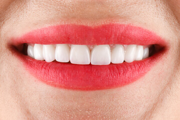 Fototapeta premium ceramic crowns and veneers