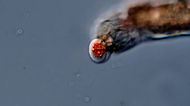 A freshwater Rotifer and amoebae under microscope
