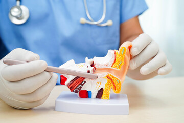 Asian doctor holding human ear model to learn and treat hearing loss in patient.