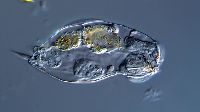 Movement of Rotifer under microscope view, DIC microscopy 
