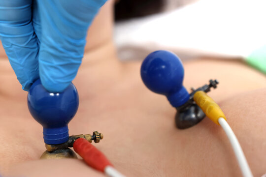 For testing, cardiograph suction cups are attached to the patient.