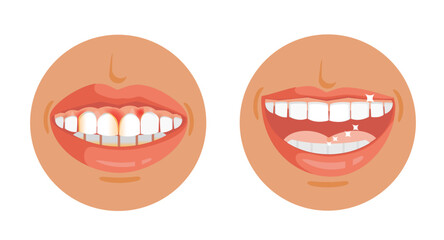 Good and bad dental health