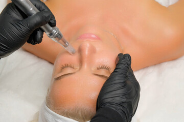 Microneedle RF lifting procedure. A cosmetologist performs a facial rejuvenation procedure on a...