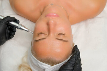 Microneedle RF lifting procedure. A cosmetologist performs a facial rejuvenation procedure on a...