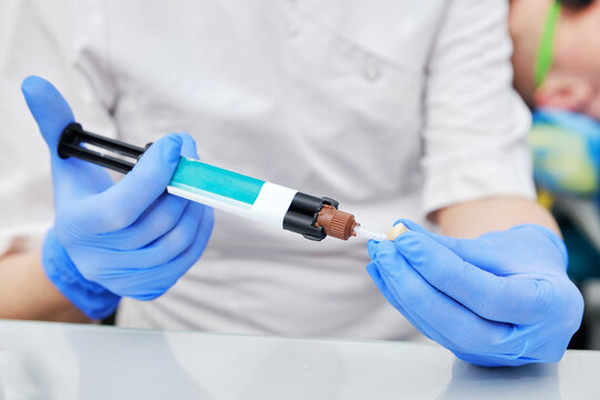 Dentist in Blue Gloves Preparing Cement for Tooth Crown. Detailed view highlighting the tools and adhesive material used for securing dental crowns.