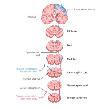 tracing the spinothalamic tract, showing how pain and temperature signals travel from the body through the spinal cord to the brain diagram hand drawn schematic raster. Medical science educational