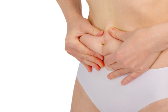 Woman showing excess skin on belly with hands, excess fat, weight loss, abdominoplasty, close-up