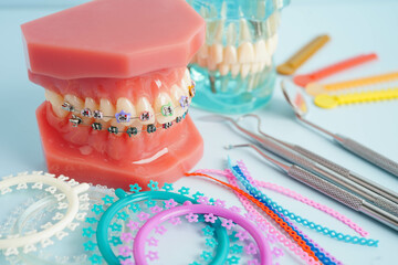 Orthodontic ligatures rings and ties, elastic rubber bands on orthodontic braces, model for dentist...