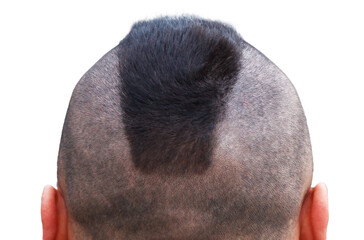 A man with a shaved head and a shaved sideburn