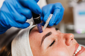 Beautician wearing blue gloves uses a microneedling pen to apply serum to forehead of client with...