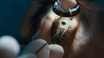 Vision correction with microscope. Surgeon's hands in gloves performing laser eye vision...