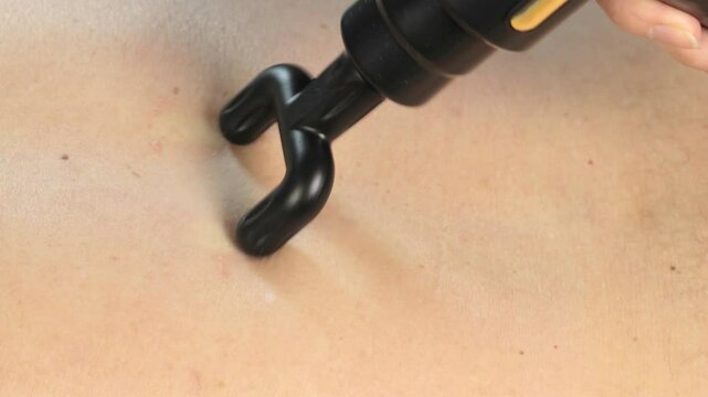 Physiotherapy and rehabilitation after intervertebral hernia on spine. Massage on man's back with percussion massage gun. Close up, 4k footage.