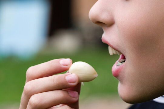 Close-up of a child with braces about to eat a single clove of garlic outdoors with a blurred green background.