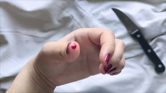 Blood is running from a woman's finger, and a kitchen knife is in the background. The concept of carelessly cutting your hand with a kitchen knife. Bleeding.