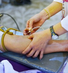 The hand of a man who donates blood. Male donor gives blood in a blood donation center in Hospital