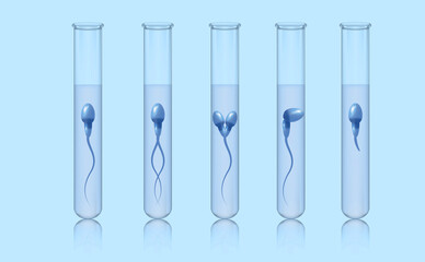 Morphology, spermatazoid in a medical test tube. A set of test tubes with spermatozoa. Sperm motility analysis. Medical poster.
