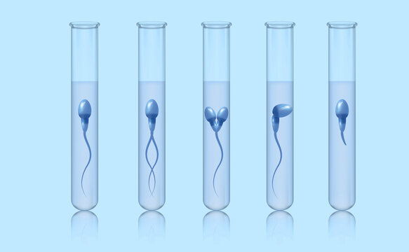 Morphology, spermatazoid in a medical test tube. A set of test tubes with spermatozoa. Sperm motility analysis. Medical poster.