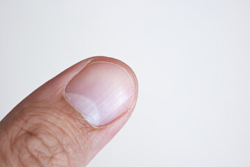Caucasian male's thumb finger or fingertip. Macro close up shot, isolated on white