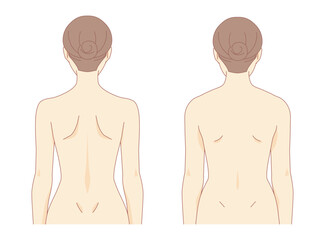 若々しい背中と老けた背中のイラスト