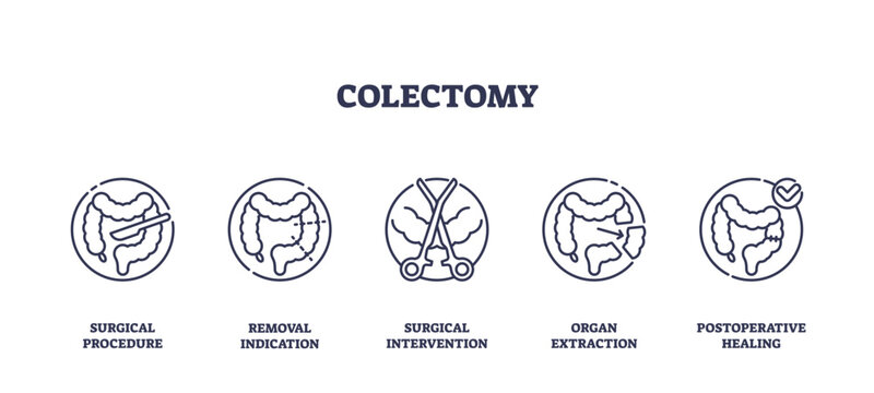 Colectomy is depicted with outline icons showing colon surgery steps, surgical tools, and healing process. Outline icons set