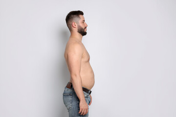 Man before weight loss on light background