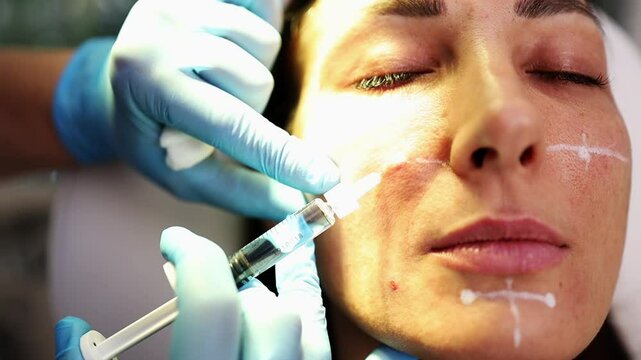 Attractive young woman is getting a rejuvenating facial injections at beauty clinic. The expert beautician is filling female wrinkles with botulinum toxin injections or hyaluronic acid fillers.