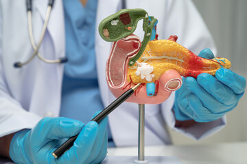 Pancreatitis, pancreatic cancer, Asian doctor with pancreas, gallbladder and bile duct human...