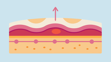 Layered Skin Structure A crosssection view of skin layers highlighting improvements with arrows indicating smoother surface layers after exosome therapy.