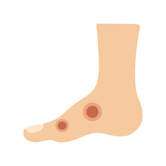 anthrax infection disease concept