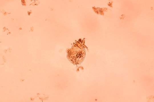 Image of pubic lice in microscopy from urine specimen.Pthirus pubis or Pediculosis pubis living according to pubic hair and the human body.Human parasite concept.