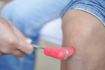 Doctor neurologist knocking on knee of patient with hammer in clinic closeup. Diagnosis of...