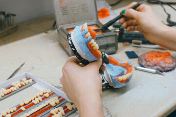 Expert technician crafts custom dentures with precision and care