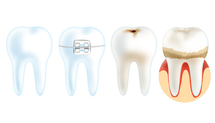 Many types of teeth are isolated on a transparent background, including healthy teeth, oral health, and resin composite filling. 