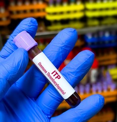 Blood sample for Immune Thrombocytopenic Purpura (ITP) test, idiopathic thrombocytopenic purpura....