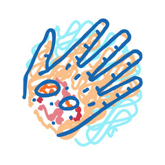 Fototapeta premium epidermolysis bullosa disease icon doodle illustration