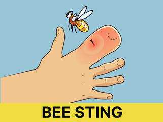 Bee sting. Healthcare illustration. Cartoon illustration. Vector illustration.