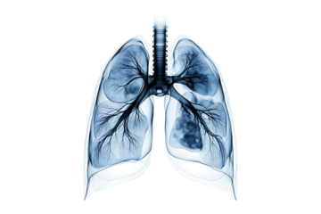 Digital Xray Scan of Lungs isolated on transparent background
