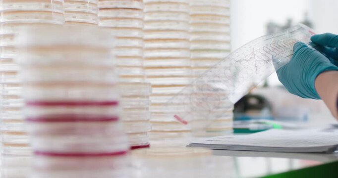 Bacterial colonies ferment lactose on MacConkey agar in the microbiology laboratory during an experiment. Concept studying and diagnosing intestinal infections using specialized culture media.