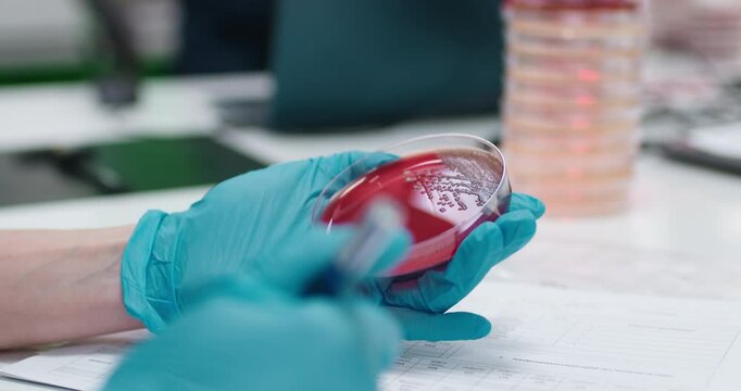 Bacterial colonies ferment lactose on MacConkey agar in the microbiology laboratory.
Concept using Petri dishes to transfer colonies to another plate for further study.