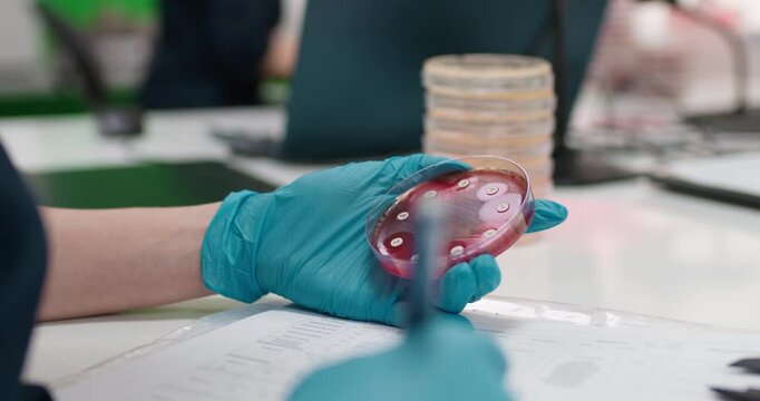 A microbiologist manually handles a Petri dish with an inoculating loop in the laboratory. Concept meticulous study of microorganisms using precise laboratory tools.