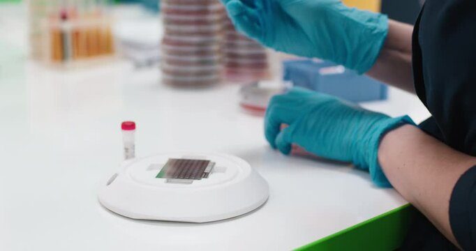 Bacterial colonies ferment lactose on MacConkey agar in the microbiology laboratory during an experiment. Concept studying and diagnosing intestinal infections using specialized culture media.