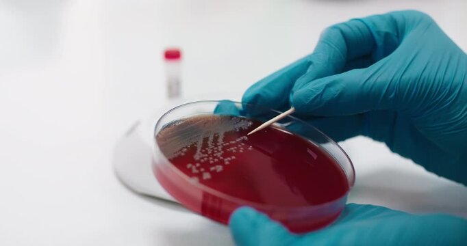 A microbiologist manually handles a Petri dish with an inoculating loop in the laboratory. Concept meticulous study of microorganisms using precise laboratory tools.