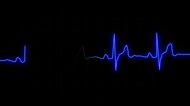 EKG heartbeat monitor display. Blue cardiogram heart rhythm for medical video. Seamless loop.