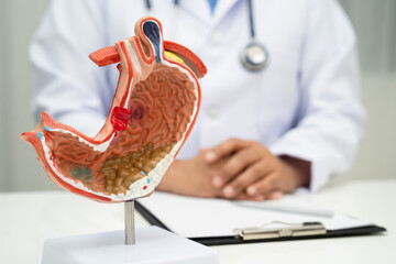 Stomach disease, doctor holding anatomy model for study diagnosis and treatment in hospital.