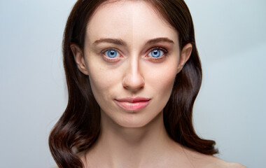Portrait of a Woman Showcasing a Split-Skincare Comparison Before and After Treatment..