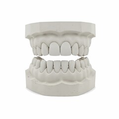 Dental Model Plaster Figure Illustration